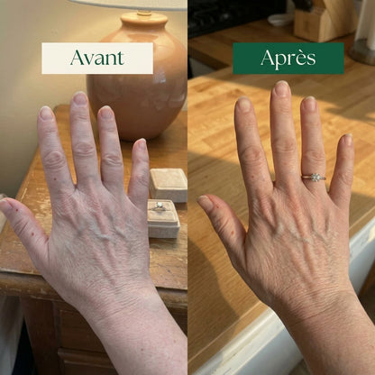 Atelier Novar – Drainage Lymphatique